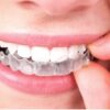invisalign Essex