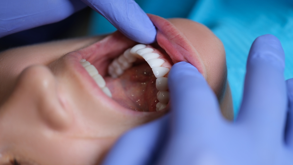 Dental veneers Essex