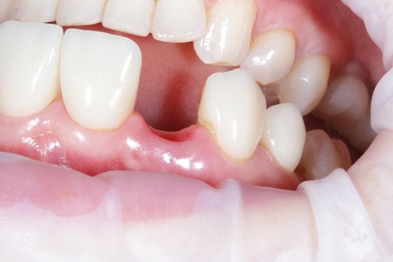 Dentist Essex