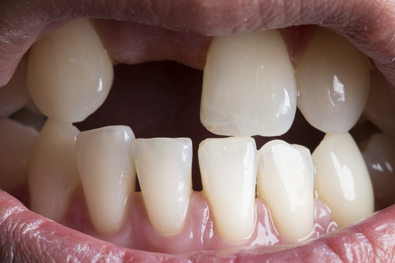 Dentist in Essex, Hornchurch