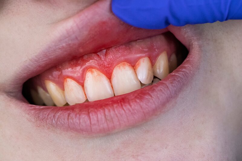 Dentist in Hornchurch, Essex