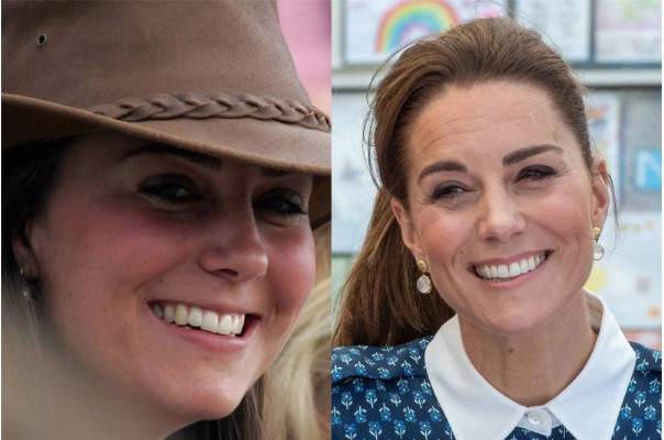 Secret Celebrities Use for Perfect Teeth
