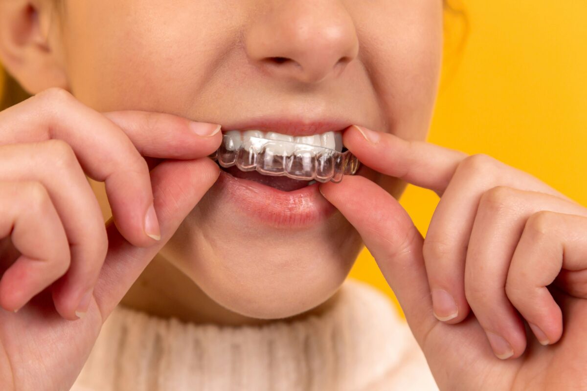 Dental mouth guard