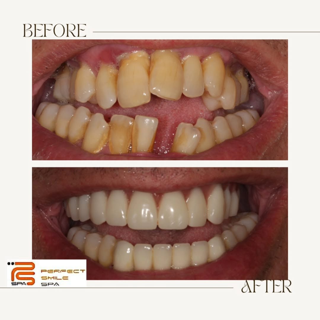 Private dentist Essex