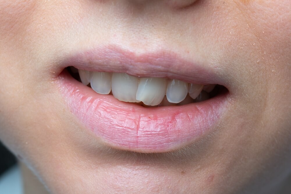 Cosmetic dentist Essex