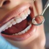 Periodontal treatment Essex