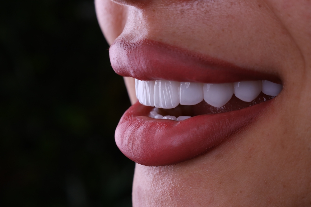 Smile makeover Essex