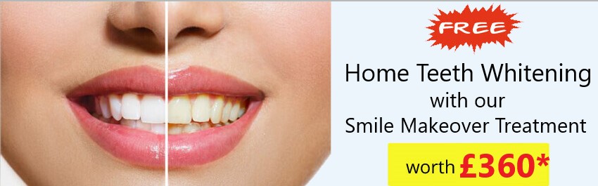 Dental Treatment Offers Essex