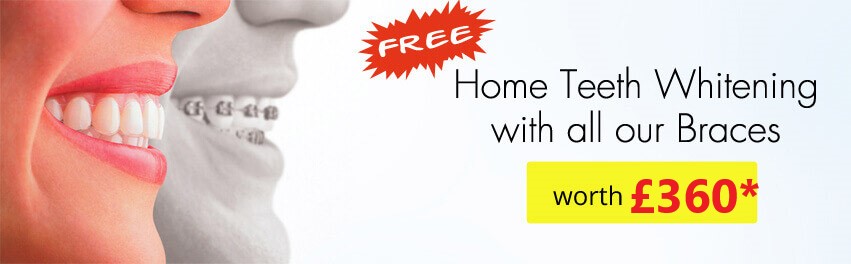 Dental Treatment Offers Essex