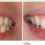 How to Read a Dentist’s Before & After Photos (And What They Really Mean)