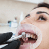 Veneers and Bonding