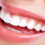 Why Your Teeth Are Shifting (Even After Braces)