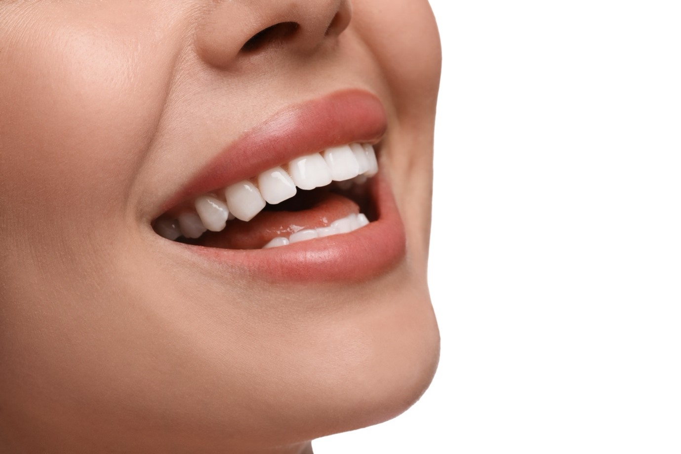 Professional Teeth Whitening 