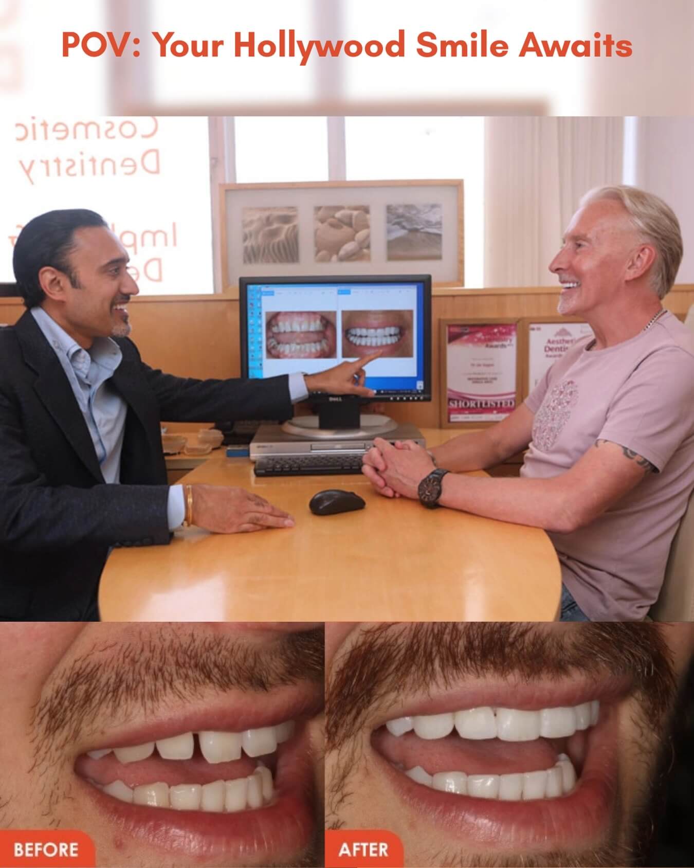 Smile makeover Essex