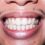 Is Your Smile Ageing You? The Subtle Dental Fixes People Are Choosing Recently