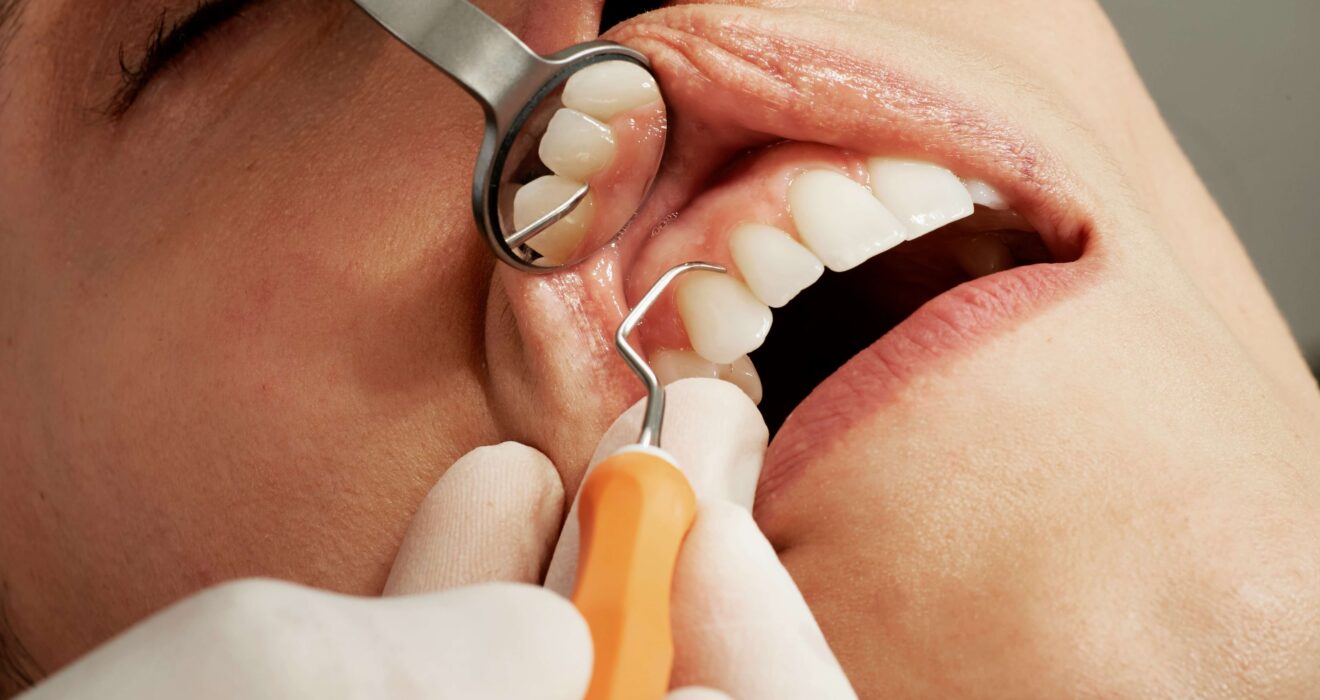 7 things that could be damaging your teeth