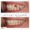 What Happens to Postponed Dental Work: The Bone Loss Timeline